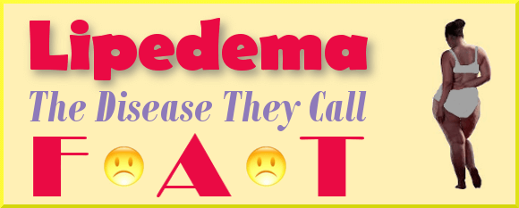 Lipedema - The Disease They Call Fat